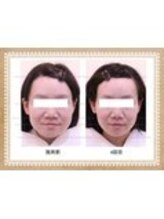 ビキュール 表参道店(美cuol)/ゆがみも撃退！