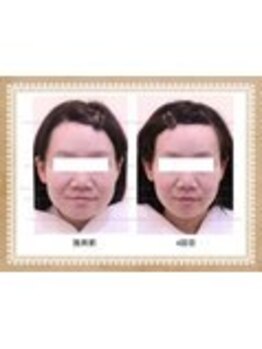 ビキュール 表参道店(美cuol)/ゆがみも撃退!