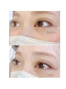 サーティースリー 横浜元町(Thirty3)/【まつ毛パーマ】Before/After