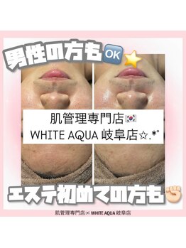 ホワイトアクア 岐阜店(WHITE AQUA)/ララピール/ハーブピーリング