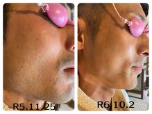 フィズ 五日市彩が丘店(FIS)/☆before/after☆都度払い