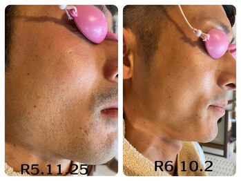 フィズ 五日市彩が丘店(FIS)/☆before/after☆都度払い