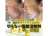 【顎肉撃退】大人気レモンボトル　ダウンタイムのない脂肪分解¥19800→¥16500