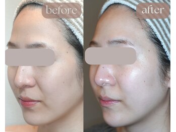 岩川治療院/乾燥肌からツヤ肌へ