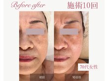 パルタージュ 三宮(Partage)/結果出しはお任せくださ！