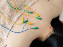 アンドリードット 堀江(&re.)/鍼灸施術