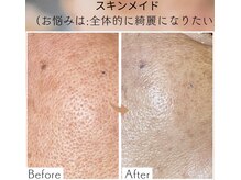 リラクゼーションサロン ラキ(laki)/スキンメイド/トロイアルケ