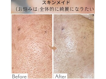 リラクゼーションサロン ラキ(laki)/スキンメイド/トロイアルケ