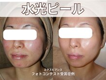 ポレ サロ(pore salo)