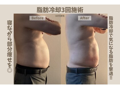 美容痩身ラボ 松山院の写真