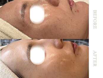 ソワ 恵比寿(soi)/ENVIRONエンビロンフルコース