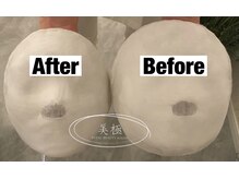 美極 トータルビューティー(美極 TOTAL BEAUTY)/恵比寿/小顔コルギ/エステ/