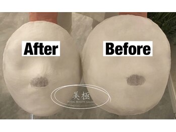 美極 トータルビューティー(美極 TOTAL BEAUTY)/恵比寿/小顔コルギ/エステ/