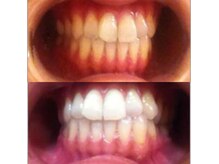 ホワイトニングスクエア バイ アバンティ(Whitening Square by Avanti)の雰囲気（★ビフォーアフター★定額通い放題プランあり）