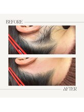 スプランドゥール(Splendeur)/レディース【うなじ】 &nbsp;Wax＋光