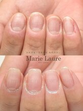 マリーロール 淀屋橋本店(Marie Laure)/自爪育成/深爪矯正/ネイルケア