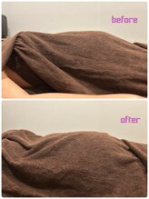 イチ(ichi)/マタニティ30週