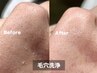 【スキンケア】まずはお試し★小鼻のみの毛穴洗浄 ¥3,000(初回のみ)
