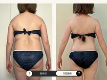 シーアンル(C.aneL)