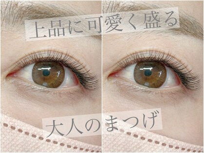 シェノン(Chainon)の写真