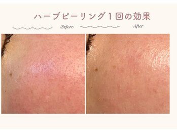 エステティックサロン シーズ/乾燥によるざらつきにも◎