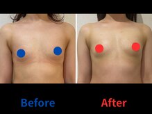 ポインセチア(Poinsettia)/ダイナミックバスト3DX/並び比較