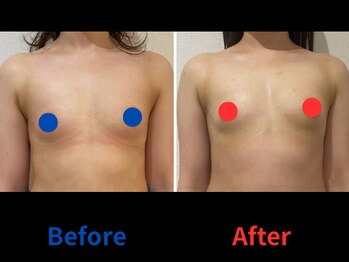 ポインセチア(Poinsettia)/ダイナミックバスト3DX/並び比較