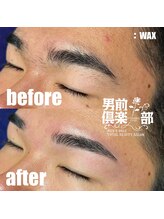 男前倶楽部/脱毛/メンズ脱毛/メンズ専門店