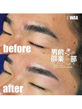 男前倶楽部/脱毛/メンズ脱毛/メンズ専門店