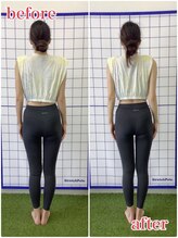 ブライフ(BLIFE)/Before & After