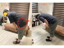 康整体院/腰が辛くて、あおむけが辛い汗