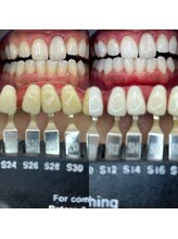 トウキョースワーズ 渋谷店(TOKYO SWRS)/#ホワイトニング #渋谷 #池袋