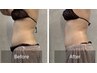 【厚み撃退】ウルトラ痩身*二の腕+背中+ウエスト腰回り90分¥21000→¥13000