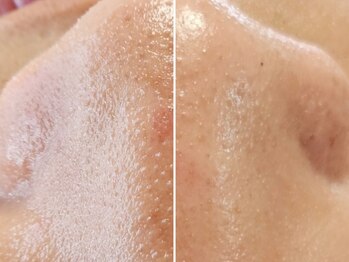 ユウビジン(YOU美人)/