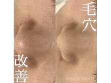 レスイズモア 恵比寿(less is more.)の雰囲気（温泉由来の成分で希少ケア!［ニキビケア/肌質改善/毛穴］）