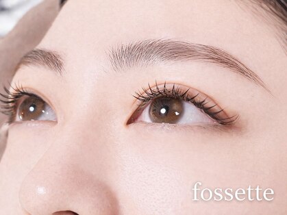 フォセット(fossette)の写真