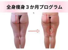 エルナ(Eluna)/40代全身10回　全身105分コー