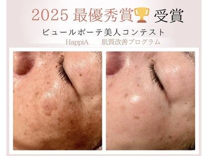 ハピア(HappiA)の写真