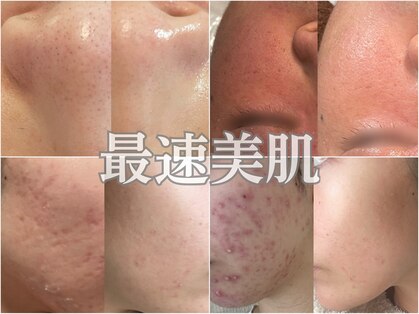 プラウディア(PROUDIA)の写真