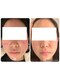 パリライム(parislime)の写真/トラブル肌ビフォーアフター全国コンテスト準グランプリ★酒さ/赤ら顔/ニキビご相談ください！