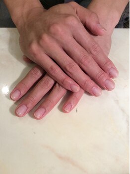 リオッサ オブ ラグーン(RIOSSA of Lagoon)/メンズ。深爪改善