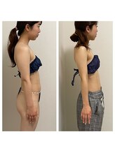 ハピネスビューティーサロン(happiness beauty salon)/WINBACK症例