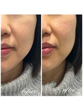 シーズボーテ(C's Beaute)/自分の行動次第で肌は変わります