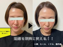 デュライラビューティーサロンルリアン(Dulailah beauty salon le line)の雰囲気（全てのお肌に対応できるオリジナル基礎化粧品で解決♪）