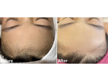 アールイー(Re:)/