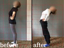 ヴレ 福岡店(Vraie)/ピラティスで産後の腰痛解消！