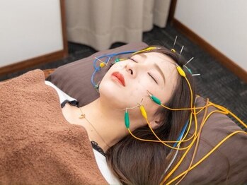 ベル(BELLE)の写真/《美容鍼をやってみたい方へ》初めてでも気軽にお試し出来るコースのご用意あり!様々なお顔のお悩み改善♪