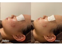 アネル 浦添店(anel)/