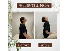 美容整体LUNOA　神戸三宮院/根本まで届く技術で痛みから解放