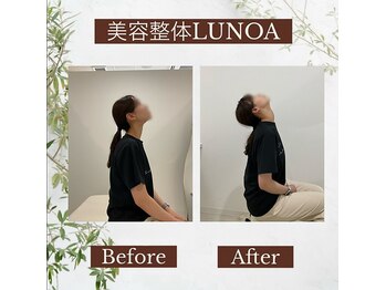 美容整体LUNOA　神戸三宮院/根本まで届く技術で痛みから解放